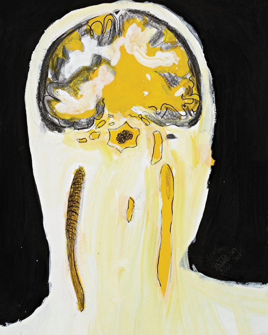 Beyin 1 / Brain 1